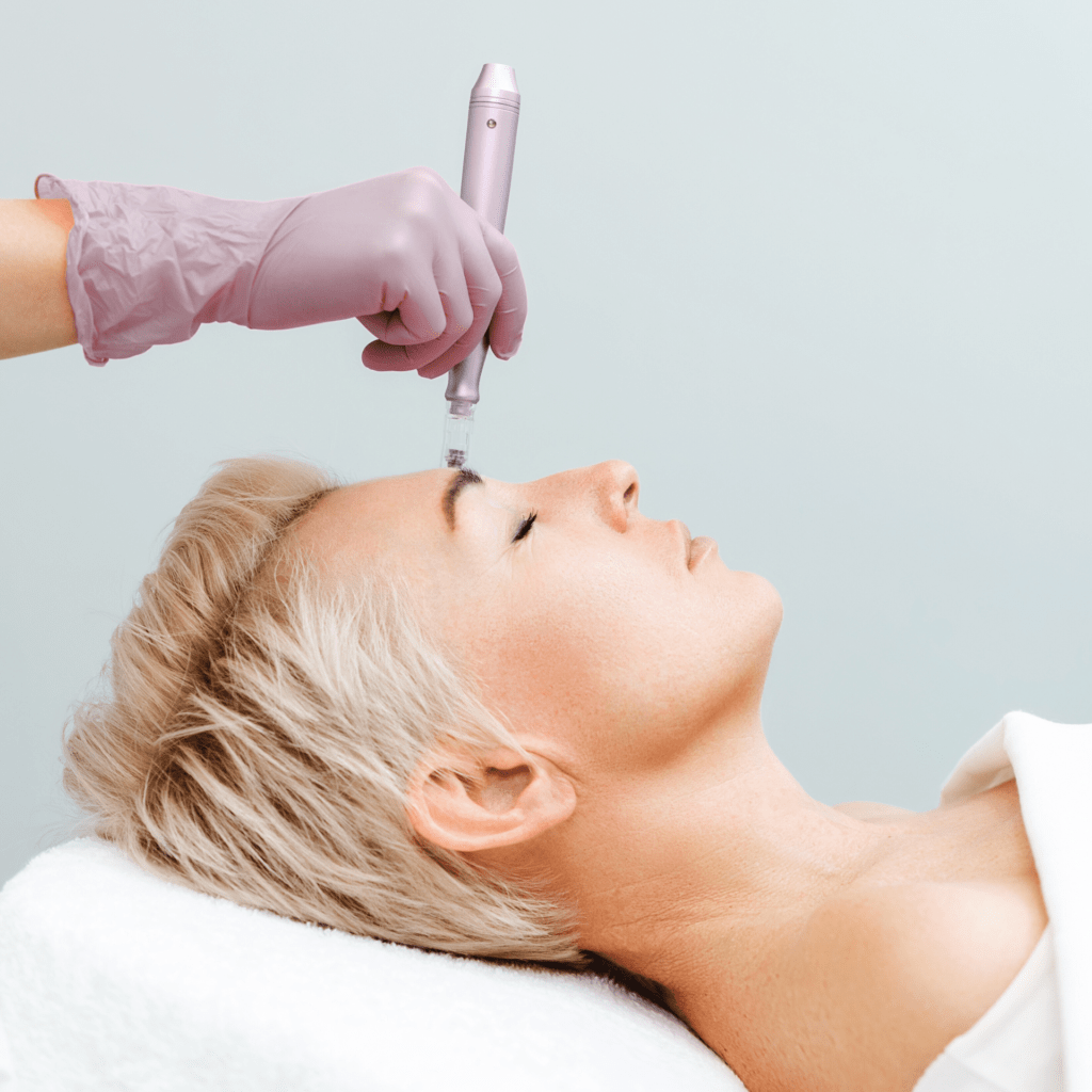 skin microneedling vancouver