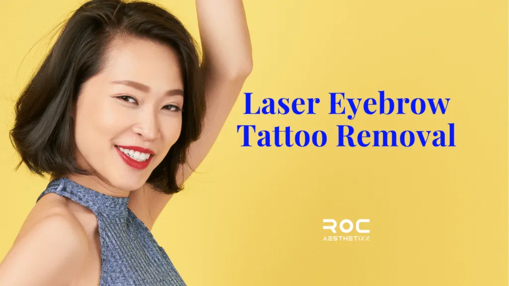Best Laser Eyebrow Microblading Tattoo Removal in Vancouver