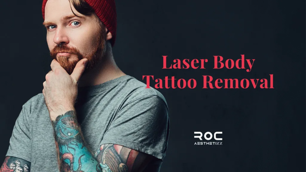 best vancouver Laser Body Tattoo Removal