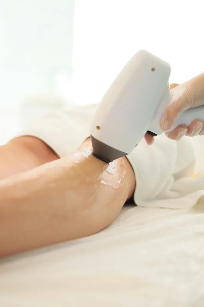 Best laser hair removal Vancouver